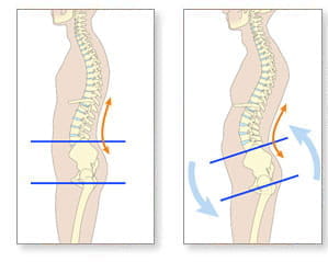 back problems and pain